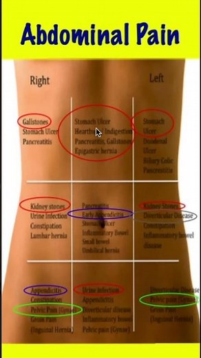Abdominal Pain Differential Diagnosis