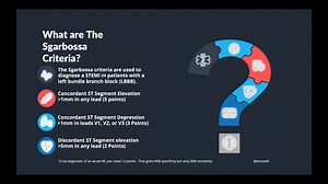 What are The Sgarbossa Criteria? The Sgarbossa criteria are used to diagnose a STEMI in patients with a left bundle branch block (LBBB). Concordant ST Segment Elevation >1mm in any lead (5 points) Concordant ST Segment Depression >1mm in leads V1, V2, or V3 (3 Points) Discordant ST Segment elevation >5mm in any lead (2 Points) To be diagnostic of an acute MI, you need >3 points. That gives 96% specificity but only 36% sensitivity Read more at: https://litfl.com/ 🚑 Be Better At EMS 🚑 . . . #ems