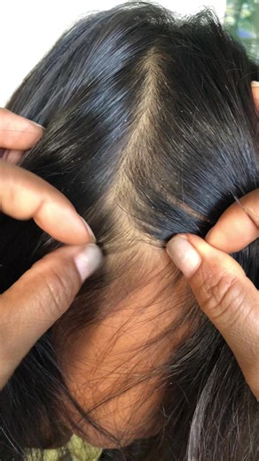 Lice Majestic Routine: Attractive Tips for Managing Lice