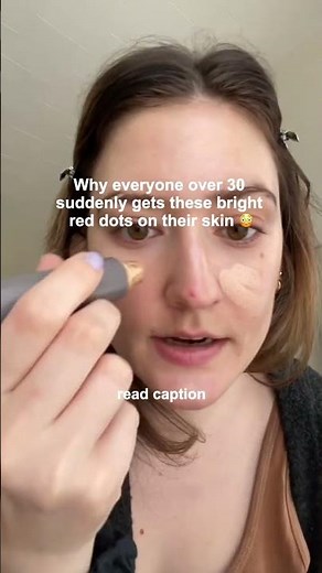 Why everyone over 30 suddenly gets these bright red dots on their skin 😳