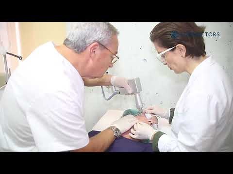 Resurfacing facial con láser CO2: mejorar la elasticidad de la piel