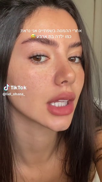תוצאות המסת שפתיים: לפני ואחרי