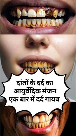 Homemade tooth powder using only 5 ingredients #shorts