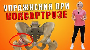 Лучшие упражнения ЛФК при коксартрозе ТАЗОБЕДРЕННОГО СУСТАВА | БЕЗ БОЛИ, лекарств и операций! | ЛФК каждый день! | Дзен