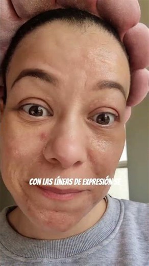 Como usar AGE-R de Medicube