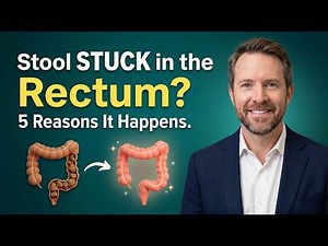 Stool STUCK in the Rectum! 5 Reasons It Happens (And What Actually Works) | Doctor Reveals