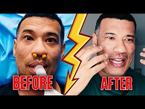 I Tried PRP For the First Time | Michael Yo