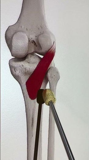 Popliteus #kinesiology #anatomy #biology #anatomystudy #biomechanics