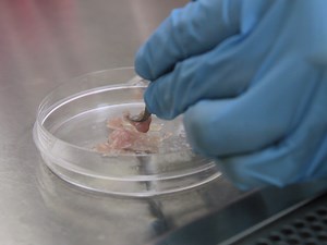 Isolation of Type I and Type II Pericytes from Mouse Skeletal Muscles