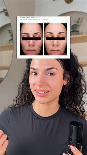 Miranda Wilson MSN-FNP on Instagram: "Not all serums are created equal. This one is formulated to support the DEJ + or what @revisionskincare likes to call the Longevity Layer™, the layer that plays a major role in how skin ages. It’s not just sitting on top.. it’s working smarter, deeper, and longer ✨"