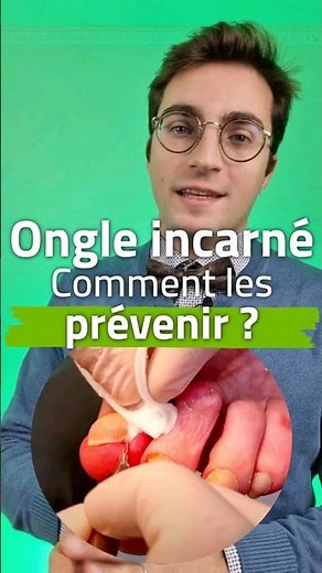 Ongle incarné : conseils de prévention et traitement