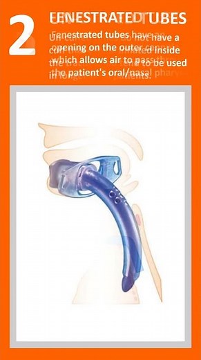 Different types of tracheostomy tubes l types of tracheostomy tube #airwaymanagement #medicaldevices