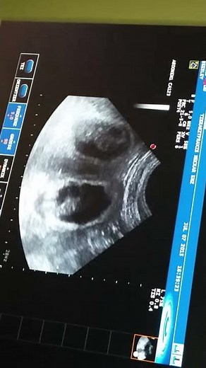 Beesley ist trächtig - Ultraschall Tag 28 nach Deckakt - Teil 2