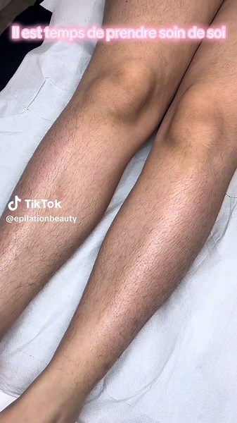 Épilation Jambe Entière et Prendre Soin de Soi