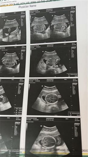 Today RCH ID Upload 😱 | Eppadi Apply Pannrathu Full Step-by-Step Guide Tamil! | How to apply rch id