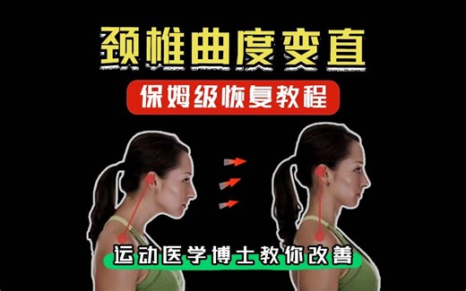 颈椎曲度变直反弓，保姆级恢复教程来啦！