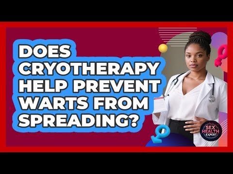 Does Cryotherapy Help Prevent Warts From Spreading? - Sex Health Expert