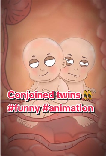 Conjoined twins 👯‍♂️ #funny #animation | animation