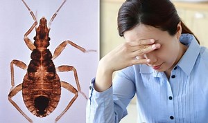 Kissing bug warning - signs and symptoms of Chagas disease