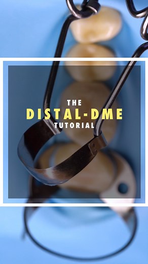dr. Farkas Péter on Instagram: "I promised a DME tutorial a few posts ago, focusing on the distal surface of the last tooth. 😮‍💨 For me, a combination of the Saddle Matrix and copper band usually works best, but there are a few key tips to keep in mind:✨ 💡 Tip 1: One thing that might not be so visible in the video is that you need to loosen the clamp and place the saddle matrix at the same time—often, the clamp won’t allow it to fit properly otherwise. 💡 Tip 2: I