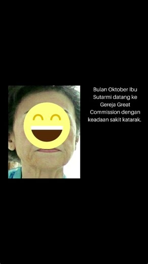Kesaksian Mukjizat Tuhan Yesus, Tanda Ajaib Kesembuhan Sakit Katarak #videoshort