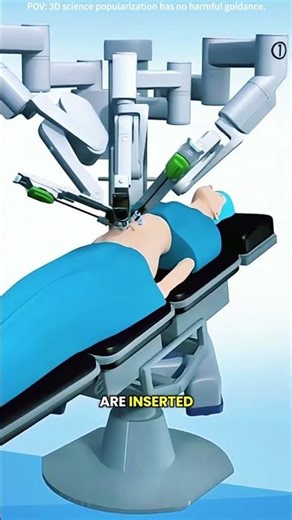 How gallbladder removal surgery is performed?(3D animation) #drone #theflash #space #microgravity