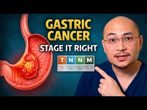 Gastric Cancer: Symptoms, Diagnosis, Staging & Treatment (Step-by-Step Guide)