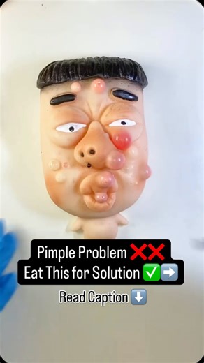 Healthy Facts and Fakes on Instagram: "Eating healthy acts like an internal “reset button” for your skin. While it might not happen overnight, shifting your diet creates a foundation for clear, resilient skin by addressing the root causes of breakouts. #healthylifestyle #viral #healthyfactsandfakes #pimplepopping #food"