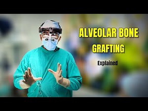 Alveolar Bone Grafting (ABG) Surgery in Cleft Children : Explained by Dr Parit Ladani