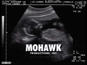 Mohawk Productions/Warner Bros Television (2000)