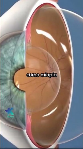 ¿Ves puntitos o hilos flotando? 👁️😳 | Miodesopsias explicadas