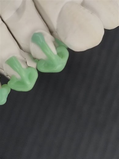 Técnicas de Encerado Dental para Estudiantes