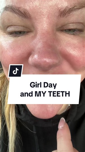 We are having a girl day. We’re getting facials and massages and doing a little shopping and something has happened to my teeth and it happened today. I am definitely not getting braces and I’m not getting Invisalign but somehow my teeth just moved today. #teethgap #gapteeth #tiktoktravel #iowagirl #asteriaspacedarrapids