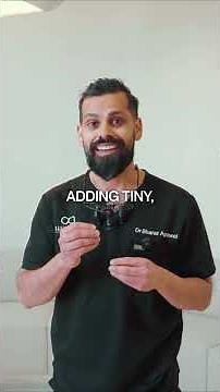 🦷 Composite Bonding vs Veneers