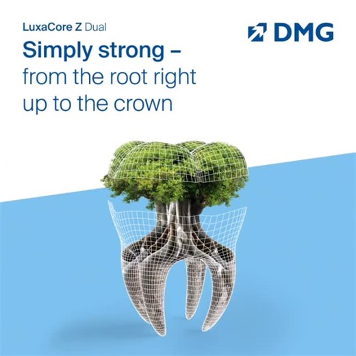 DMG America on Instagram: "Strong where it matters most. From the root to the crown, LuxaCore Z Dual delivers the strength and reliability you need for durable core build-ups and post cementation. Because every great restoration starts with a solid foundation. 🌳🦷 🔗 To learn more, visit our link in bio. #DMGAmerica #DMGDental #LuxaCoreZDual #CoreBuildUp #PostCementation #RestorativeDentistry"