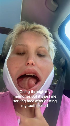 mayagmoney24 (@mayagmoney24)’s video of teeth