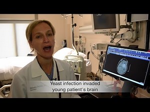 Checkups: Brain infected by fungus