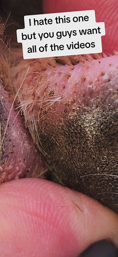 #ingrownhairremoval #impacted #impactedhair #pimplepopperaddict #impactedhairfollicles #dogpimples #dogpaws #ingrownhair