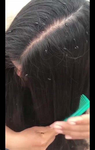 Creative Foot Art with Beaded Anklet in Nature