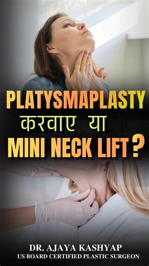Platysmaplasty करवाएं या MINI Neck Lift? | Neck Lift Surgery in Delhi #necklift #short