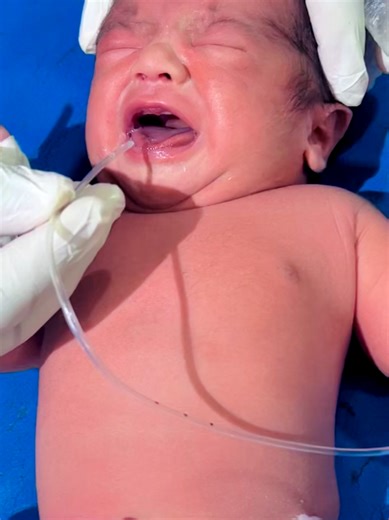 baby not breath no response 😭#viralvideo #newborn #unfreezemyaccount | baby