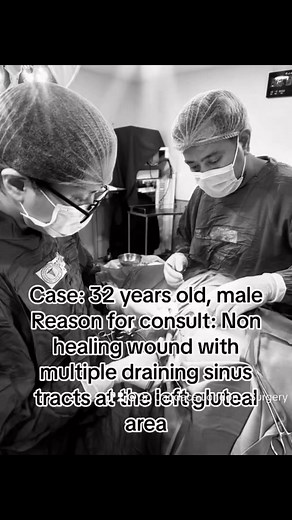 13 reactions | Debridement of carbuncle....