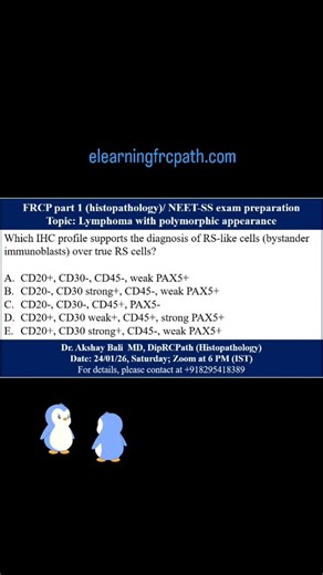 eLearningFRCPath on Instagram: "#mcq #lymphoma #rscell #neetsspathology #frcpath elearningfrcpath.com"