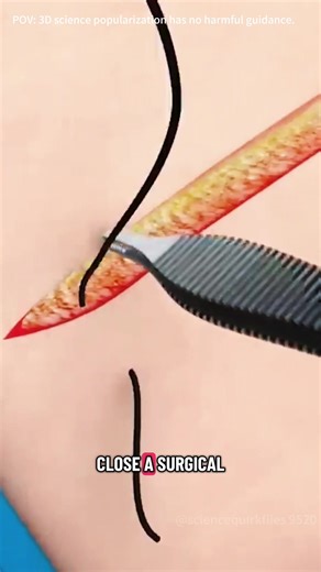 Subcuticular running suture#3danimation #fyp #meditok