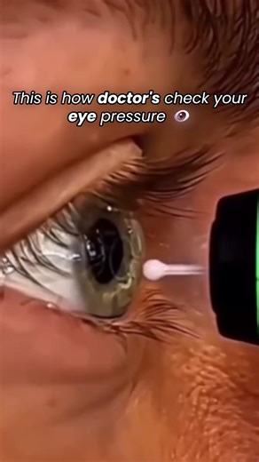 This is how doctors check your eye pressure 👀