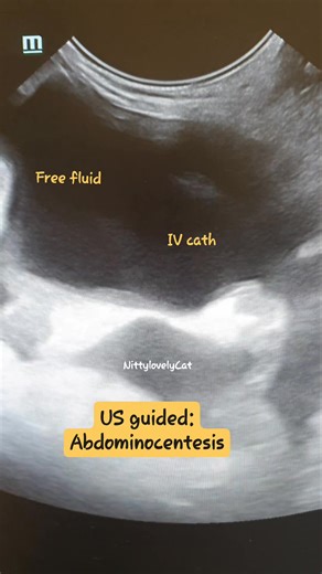 Abdominocentesis in Rt side heart failure Dog #peritonealeffusion #abdominocentesis #vet #education | Nitty LovelyCat.