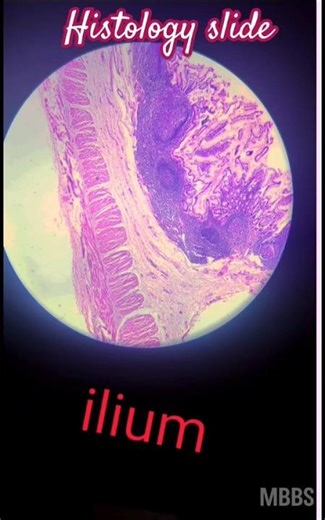 histology of Ileum | labelled diagram for Spotters | #histology #mbbs #ileum #shorts #medstudent