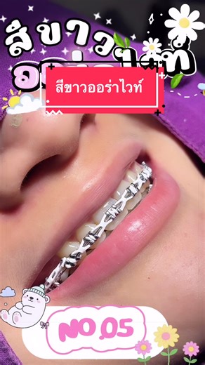 คลินิกทันตกรรมเดซี่สไมล์ โคราช เปิด10.00-20.00