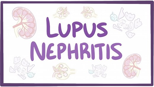 Lupus nephritis: Video, Causes, & Meaning | Osmosis