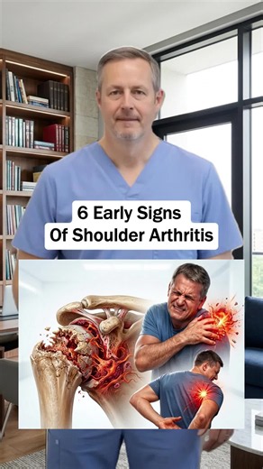 6 early signs of shoulder arthritis #shoulderpain #shoulderpainrelief #arthritis #healthy #usa_tiktok